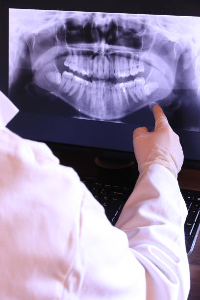 Best Emergency Tooth Extraction in Little Falls, MN