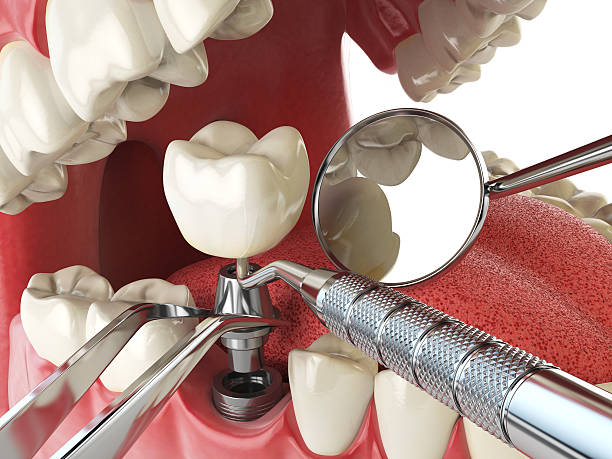 Best Walk-In Emergency Dentist in Little Falls, MN